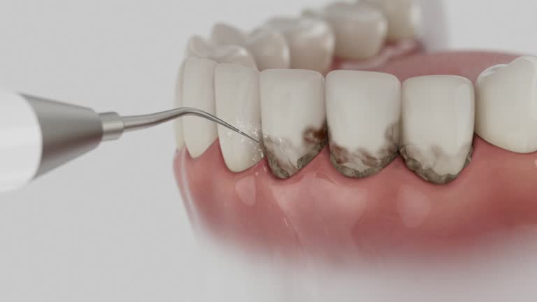 Trusted Teeth Cleaning And Checkup service in Cleveland, GA - Dentist Open Now